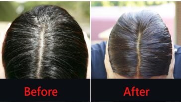 A Simple Natural Wonder That Can Get Rid of Gray Hair Permanently