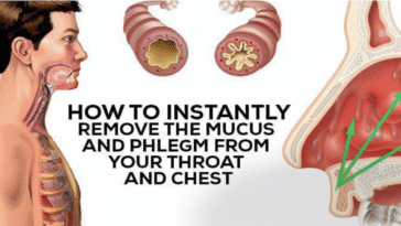 Effective Natural Remedies to Clear Phlegm and Mucus